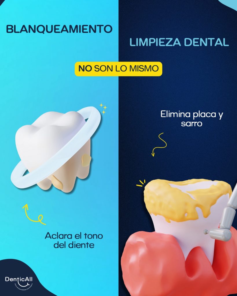 Blanqueamiento / Limpieza Dental